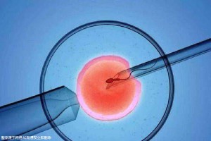 胚胎培养室
